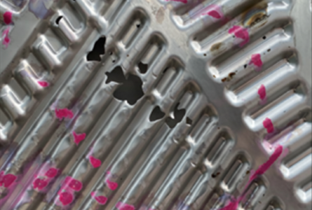 異物混入によるエロージョン